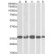 Casein Kinase II Subunit Beta (CSNK2B) Antibody