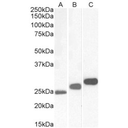 Casein Kinase II Subunit Beta (CSNK2B) Antibody