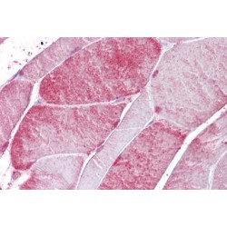 Cysteine And Glycine Rich Protein 3 (CSRP3) Antibody