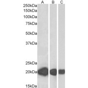 abx431193 (0.01 µg/ml) staining of Human (A), Mouse (B) and Rat (C) Heart lysate (35 µg protein in RIPA buffer). Detected by chemiluminescence.