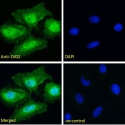 Type II Iodothyronine Deiodinase (DIO2) Antibody
