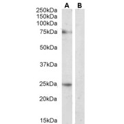 abx431207 (2 µg/ml) staining of Rat Pancreas lysate (A) + Peptide (B) (35 µg protein in RIPA buffer). Detected by chemiluminescence.