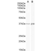 abx431208 (1 µg/ml) staining of Human Cerebellum (A) and Rat (B) Brain lysate (35 µg protein in RIPA buffer). Primary incubation was 1 hour. Detected by chemiluminescence.