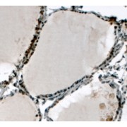 abx431228 (4 µg/ml staining of paraffin embedded Human Thyroid Gland. Steamed antigen retrieval with citrate buffer pH 6, HRP-staining.