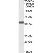 Western blot analysis of Human Cerebellum lysate (35 µg protein in RIPA buffer) using biotin-conjugated Laforin (Isoform a) Antibody (1 µg/ml). Detected by chemiluminescence, using streptavidin-HRP and using NAP blocker as a substitute for skimmed milk.