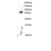 abx431241 staining (2 µg/ml) of Human Brain lysate (RIPA buffer, 30 µg total protein per lane). Primary incubated for 12 hour. Detected by chemiluminescence.