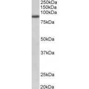 abx431251 (1 µg/ml) staining of A549 lysate (35 µg protein in RIPA buffer). Primary incubation was 1 hour. Detected by chemiluminescence.