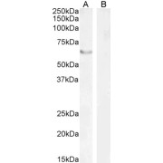 abx431254 staining (2 µg/ml) of nuclear HEK293 (A) and (1 µg/ml) negative control Human Pancreas (B) lysate [RIPA buffer, 35 µg total protein per lane). Detected by chemiluminescence.