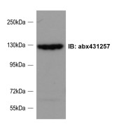 abx431257 (0.1 µg/ml) staining of Rat Cortical Neuron lysate (35 µg protein in RIPA buffer). Primary incubation was 1 hour. Detected by chemiluminescence. Data kindly provided by Ms. Ya-Jing Mi and Dr.Wei-Lin Jin, Institute of Neurosciences, Shanghai Jiao Tong University.