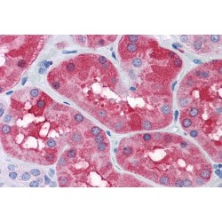 Ferritin, Light Polypeptide (FTL) Antibody