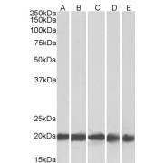 abx431259 (0.3 µg/ml) staining of Human Brain (Cerebellum) (A), Liver (B), Human Placenta (C) 22kDa in MBR (D), RBR (E) lysate (35 µg protein in RIPA buffer). Primary incubation was 1 hour. Detected by chemiluminescence.