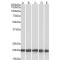 Ferritin, Light Polypeptide (FTL) Antibody