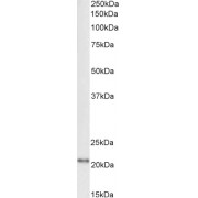 Western blot analysis of Rat Brain lysate (35 µg protein in RIPA buffer) using biotin-conjugated Ferritin, Light Polypeptide (FTL) Antibody (1 µg/ml, 1 hour). Detected by chemiluminescence, using streptavidin-HRP and using NAP blocker as a substitute for skimmed milk.