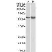 abx431263 (0.3 µg/ml) staining of A431 (A) and Jurkat lysate (B) (35 µg protein in RIPA buffer). Primary incubation was 1 hour. Detected by chemiluminescence.