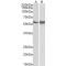 FYN Oncogene Related To SRC, FGR, YES (FYN) Antibody
