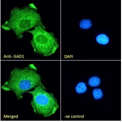 GAD1 (Isoform GAD67) Antibody