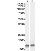 Western blot analysis of Mouse Brain (A) Small Intestine (B) and Stomach (C) lysate (35 µg in RIPA buffer) using Galanin (GAL) Antibody (1 µg/ml).