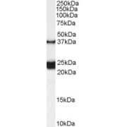 abx431277 (0.1 µg/ml) staining of Rat Spinal Cord lysate (35 µg protein in RIPA buffer). Primary incubation was 1 hour. Detected by chemiluminescence.