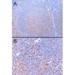 GATA Binding Protein 3 (GATA3) Antibody