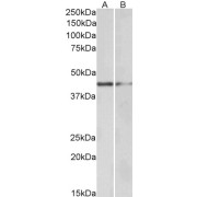 abx431281 (0.5 µg/ml) staining of Human Tonsil (A) and Mouse Kidney (B) lysate (35 µg protein in RIPA buffer). Primary incubation was 1 hour. Detected by chemiluminescence