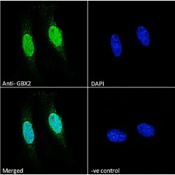 Gastrulation Brain Homeobox 2 (GBX2) Antibody