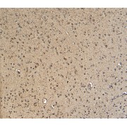 abx431282 (5 µg/ml) staining of paraffin embedded Human Cortex. Heat induced antigen retrieval with citrate buffer pH 6, HRP-staining.