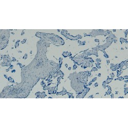 Gastrulation Brain Homeobox 2 (GBX2) Antibody