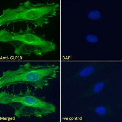 Glucagon-Like Peptide 1 Receptor (GLP1R) Antibody