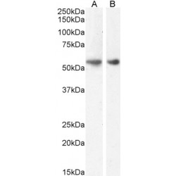 Glucagon-Like Peptide 1 Receptor (GLP1R) Antibody