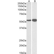 abx431290 (0.03 µg/ml) staining of Human (A) and Mouse (B) Brain lysate (35 µg protein in RIPA buffer). Detected by chemiluminescence.