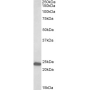 abx431291 (0.3 µg/ml) staining of Rat Kidney lysate (35 µg protein in RIPA buffer). Detected by chemiluminescence.