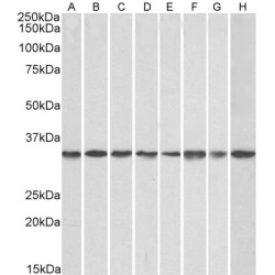Receptor of Activated Protein C Kinase 1 (GNB2L1) Antibody