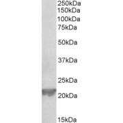 abx431303 (0.3 µg/ml) staining of Rat Liver lysate (35 µg protein in RIPA buffer). Primary incubation was 1 hour. Detected by chemiluminescence.