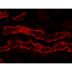 Glutathione Peroxidase 3 (GPX3) Antibody