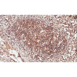 Growth Factor Receptor Bound Protein 2 (GRB2) Antibody