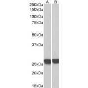 abx431306