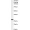 Glutathione S Transferase Mu 4 (GSTM4) Antibody