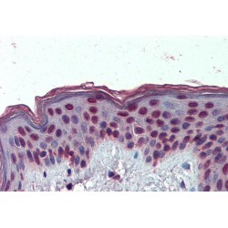 High Mobility Group Protein HMG-I/HMG-Y (HMGA1) Antibody