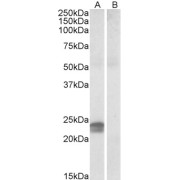 abx431324 (0.5 µg/ml) staining of Human Pancreas lysate (35 µg protein in RIPA buffer) with (B) and without (A) blocking with the immunising peptide. Detected by chemiluminescence.