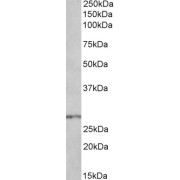 abx431332 (0.3 µg/ml) staining of Mouse Spinal Cord lysate (35 µg protein in RIPA buffer). Primary incubation was 1 hour. Detected by chemiluminescence.