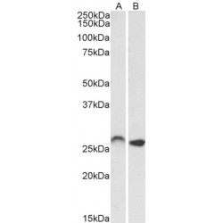 HOXC6 (Isoform 1) Antibody