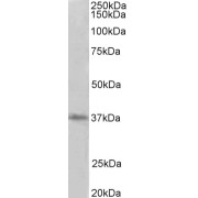 abx431339 (2 µg/ml) staining of HeLa lysate (35 µg protein in RIPA buffer). Primary incubation was 1 hour. Detected by chemiluminescence.