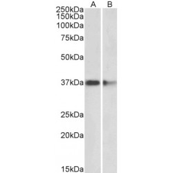 Protein Arginine N-Methyltransferase 2 (PRMT2) Antibody