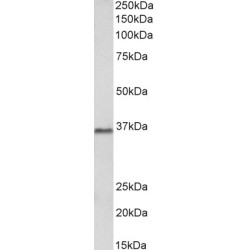 Protein Arginine N-Methyltransferase 2 (PRMT2) Antibody