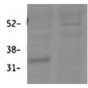 abx431341 (0.3 µg/ml) staining of Mouse Lung lysate (60 µg protein in RIPA buffer). First lane shows wildtype and second lane shows knockout background. Primary incubation was overnight. Detected by fluorescence with Li-cor.