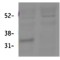11-Beta-Hydroxysteroid Dehydrogenase Type 1 (Hsd11b1) Antibody