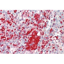 Insulin Like Growth Factor 1 (IGF1) Antibody