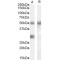 Insulin Like Growth Factor Binding Protein 3 (IGFBP3) Antibody