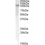 abx431355 (1 µg/ml) staining of Rat Kidney lysate (35 µg protein in RIPA buffer). Primary incubation was 1 hour. Detected by chemiluminescence.