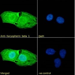 Importin Subunit Beta-1 (KPNB1) Antibody